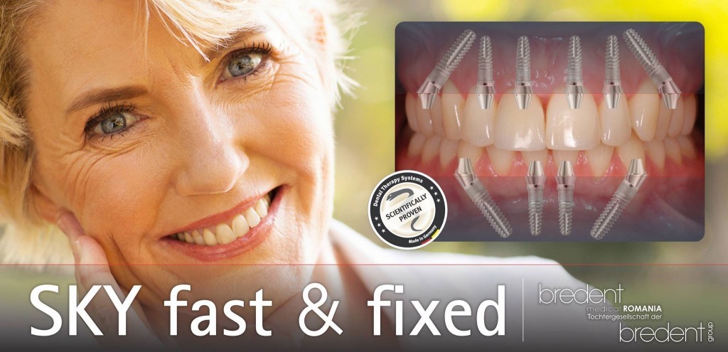 Teeth in a Day Dental Implants All on Four Six