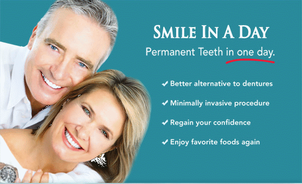 Teeth in a Day Same Day Dental Implants All on Six Four